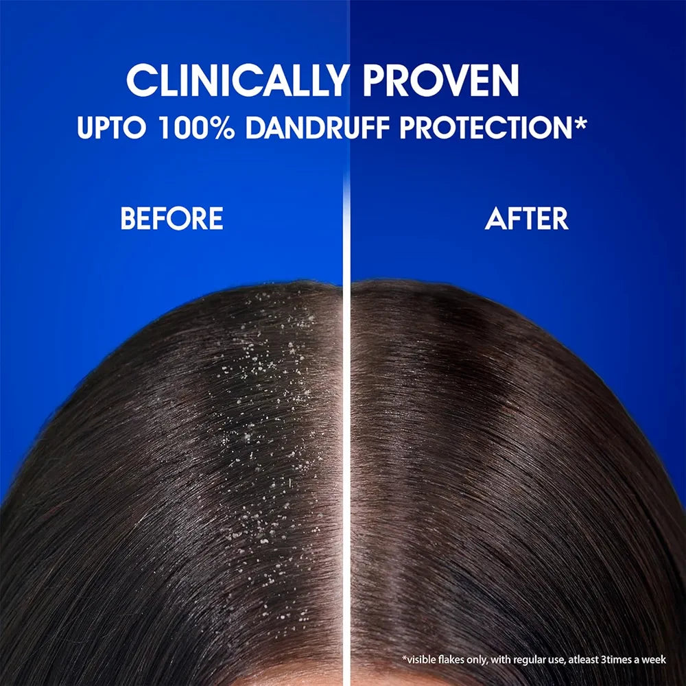 Head & Shoulders , Anti Dandruff Shampoo, Smooth & Silky - 72ml