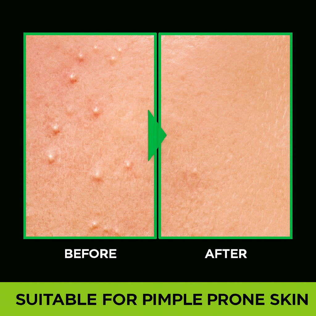 GARNIER Acno Fight Anti - Pimple Face Wash(50g)