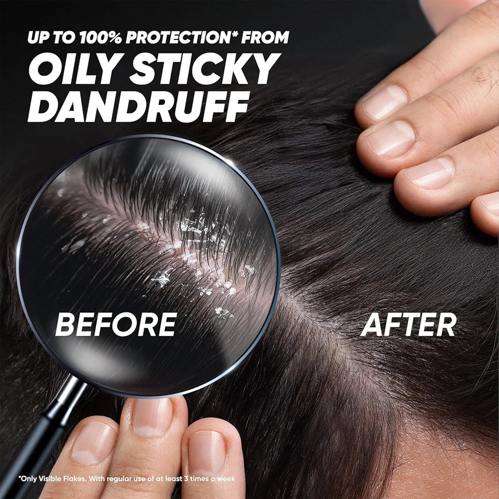Head & Shoulders Deep Cleanse Anti-Dandruff Shampoo - 180ml