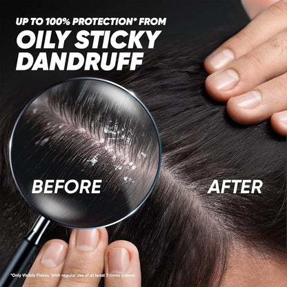 Head & Shoulders Deep Cleanse Anti-Dandruff Shampoo - 180ml
