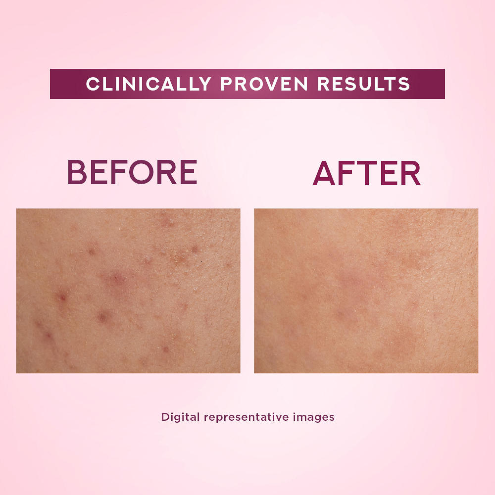 Pond's Bright Beauty Light Cream with UV Filter 35g